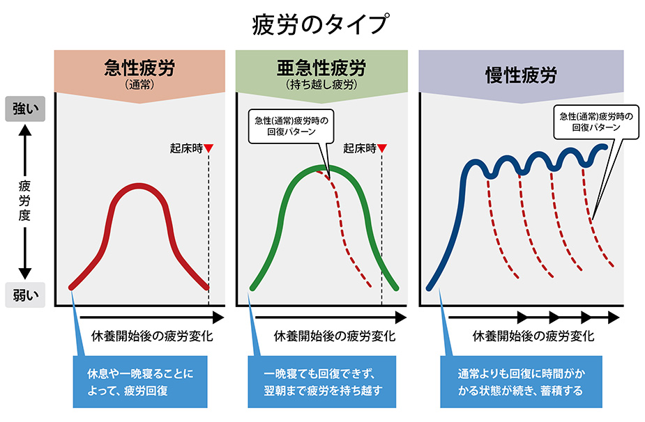 疲労のタイプ 急性疲労(通常)、亜急性疲労(持ち越し疲労)、慢性疲労