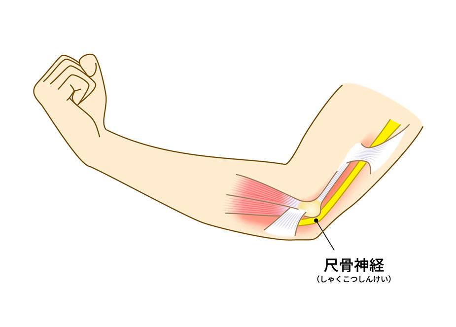 薬指しびれ コレクション 腕枕